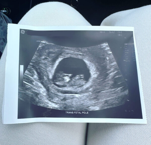 Baby Bitch Coming in 2026! Baby Bitch Coming in 2026!